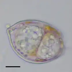Dinovorax, a perkinsid that infects dinoflagellates