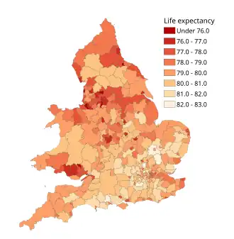 Life expectancy at birth for boys in 2012–2014 by local authority district in England and Wales.