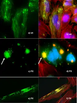 Fluorescence microscopy of DNA Expression in the Human Wild-Type and P239S Mutant Palladin