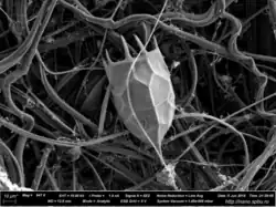 Locula of the rotifer Keratella cochlearis