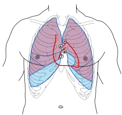 The chest, showing surface relations of bones, lungs (purple), pleura (blue), and heart (red). Heart valves are labeled with "B", "T", "A", and "P".