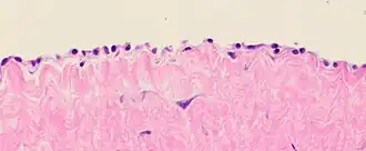 Histology of the peritoneal mesothelial lining, and underlying fibrous tissue. H&E stain.