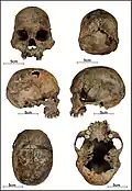 Burial 21 - Cranium