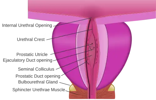 Dissection of prostate showing ejaculatory ducts opening into the prostatic urethra