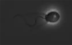 Salpingoeca (Choanoflagellatea)