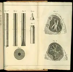 De l'auscultation médiate&nbsp;.... Drawings of the stethoscope and lungs.