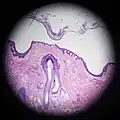 Scalp cross section showing hair follicle with sebaceous glands.