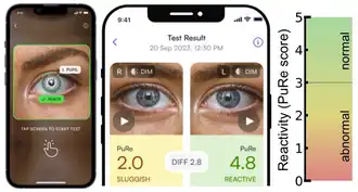 Screenshot showing a pupillometer app on a iPhone.