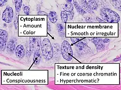 Subcellular features (may need highest magnification)