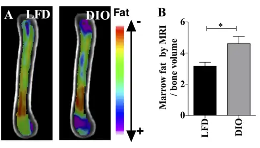 This figure demonstrates the use of MRI imaging (9.4T scanner) along with advanced image processing to quantify BMAT. The images and graph demonstrate that BMAT is higher in obese compared with lean mice. B6 mice were fed HFD from age 4 wk until age 16 wk. BMAT was quantified by MRI. A) n=10 superimposed group average images are shown B) BMAT normalized to bone volume in each group.